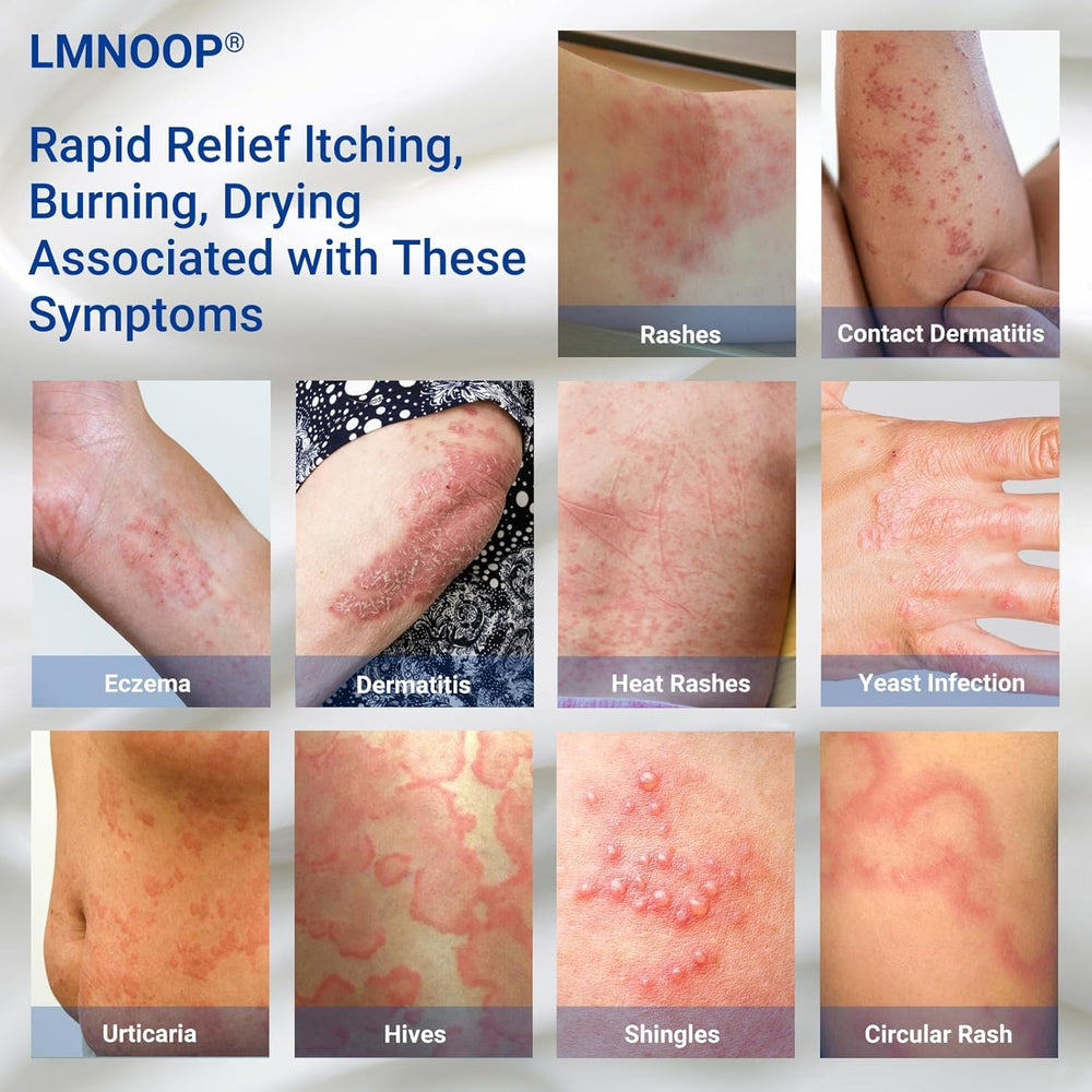 LMNOOP eczema cream application on arm demonstrates fast-absorbing relief for itchy skin.