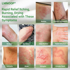 LMNOOP Eczema Cream application shows smooth, fast-absorbing formula for irritated skin.