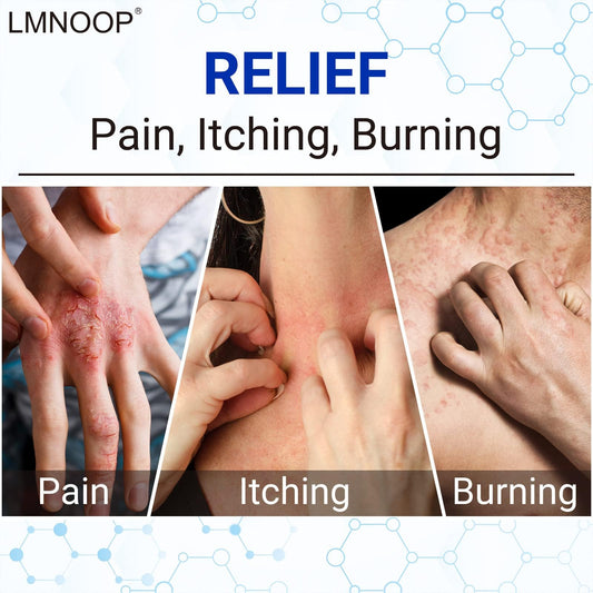 LMNOOP Eczema Cream jar shows convenient 2-pack for home care