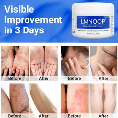 LMNOOP eczema cream packaging box showcases organic ingredients and product origin.