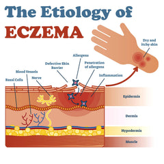 LMNOOP eczema cream swirl demonstrates creamy texture ideal for easy smoothing.