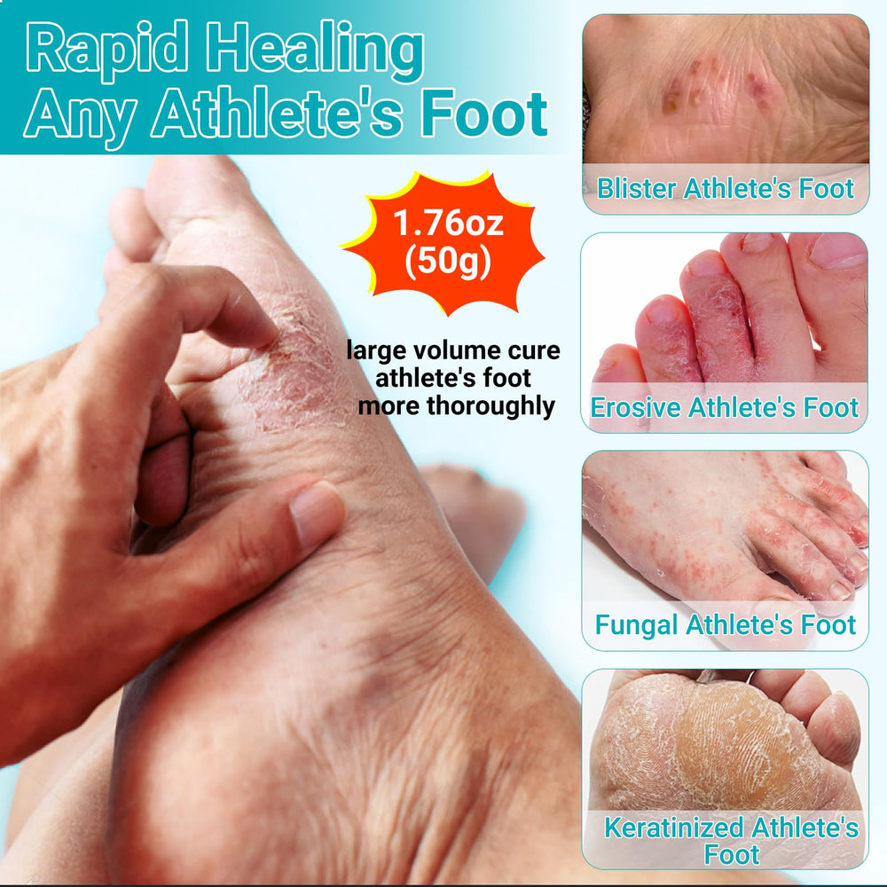 LMNOOP Foot Cream application on palm for easy rub-in.