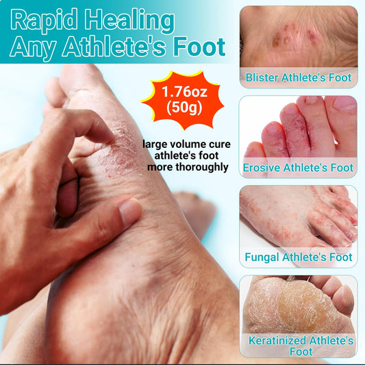 LMNOOP Foot Cream application on palm for easy rub-in.
