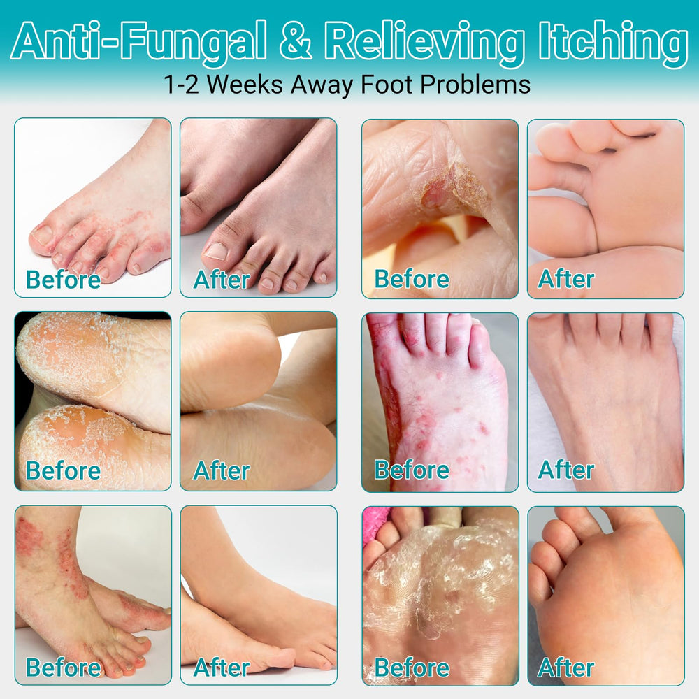 LMNOOP Natural ingredient blend featuring plant extracts for antifungal care.