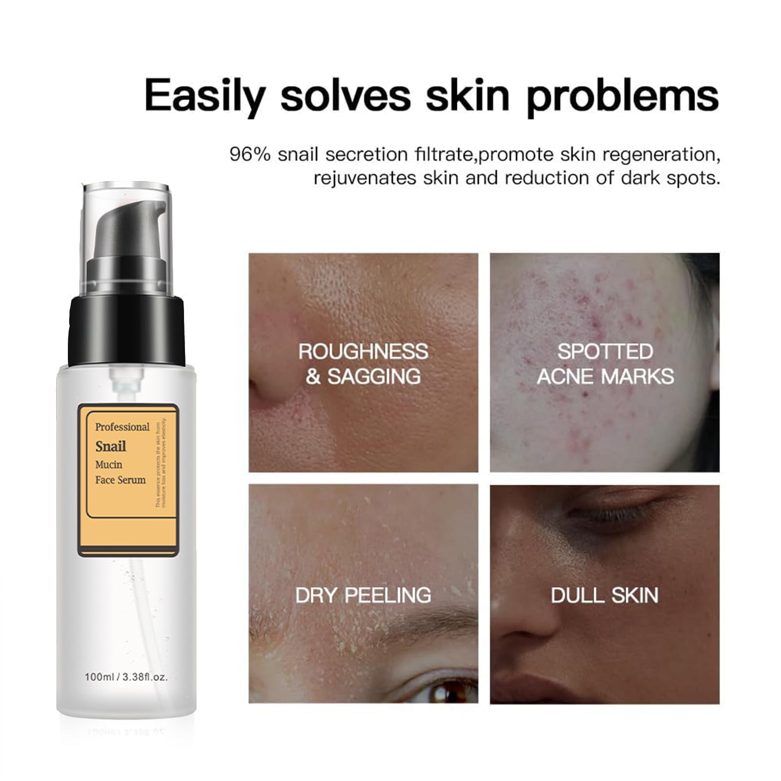 Loske Snail Mucin Serum suitable for sensitive skin for daily use.