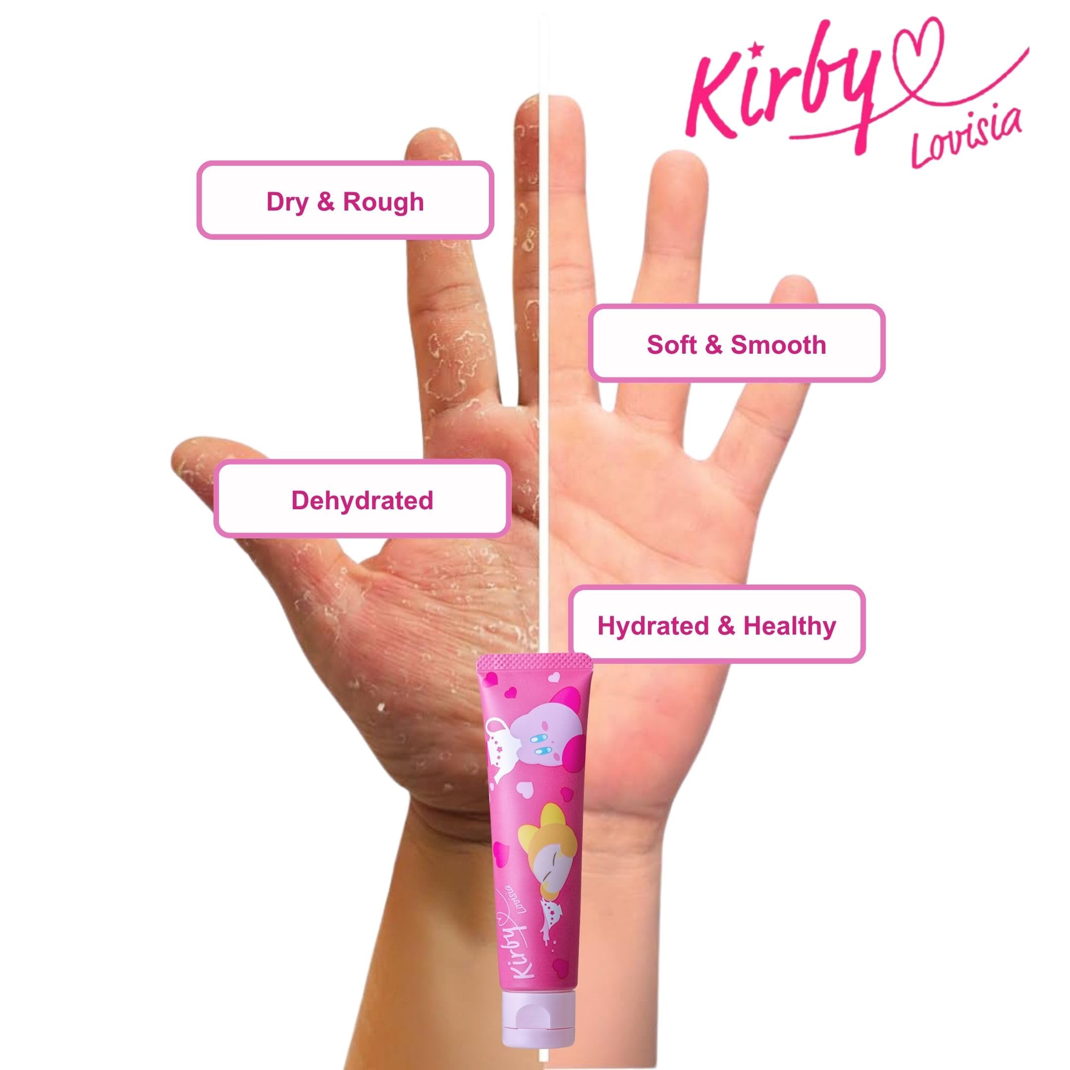 Gentle massage of Lovisia Kirby cream into palm