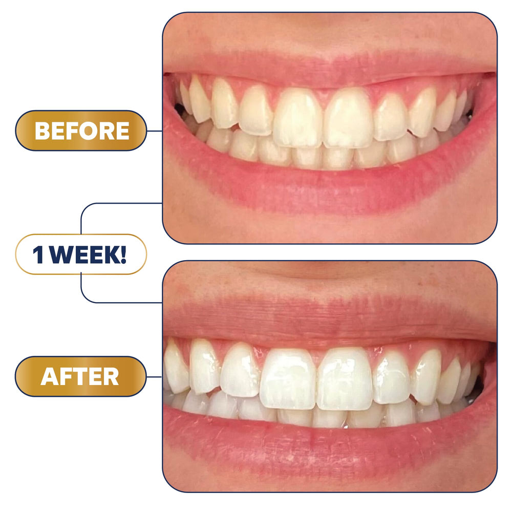 Illustration of Lumineux stain-targeting technology for clinically proven whitening