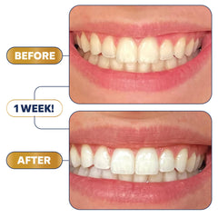 Enamel Safe Stain Targeting Technology