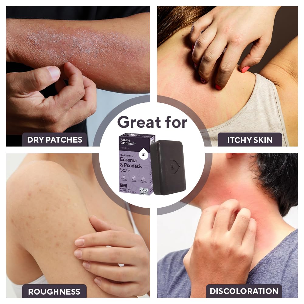 Marie Originals eczema face soap bar oat bran surface suggests soothing hydration for dry skin.