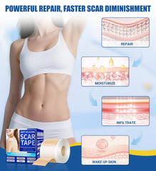 MasterMo pre-cut scar tape shapes fit varied scar contours easily.