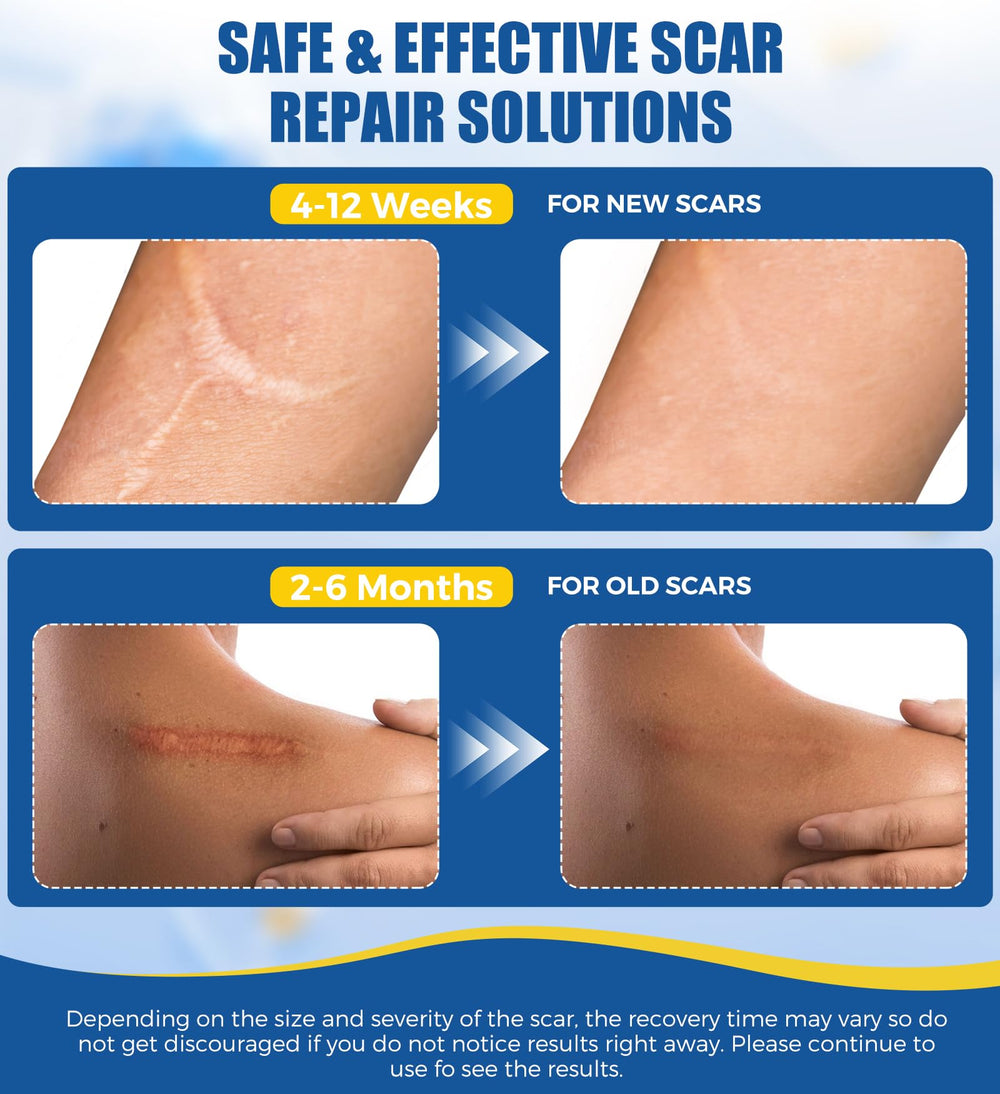 MasterMo reusable silicone scar sheets are washable and cost-effective.