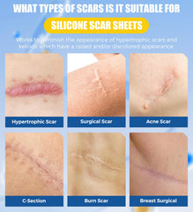 MasterMo scar tape provides a strong hold for daily activities.