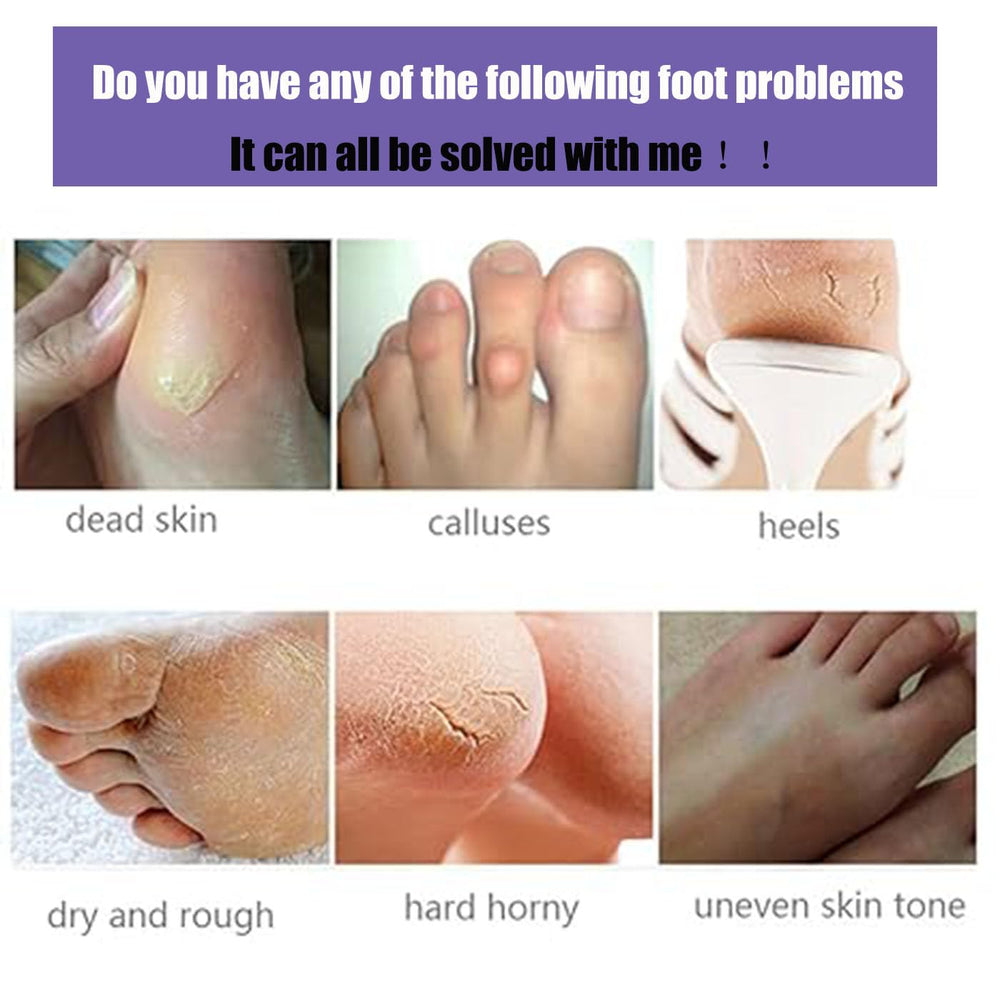Mckkymi foot peel mask 5 pack after-use soft skin reveal