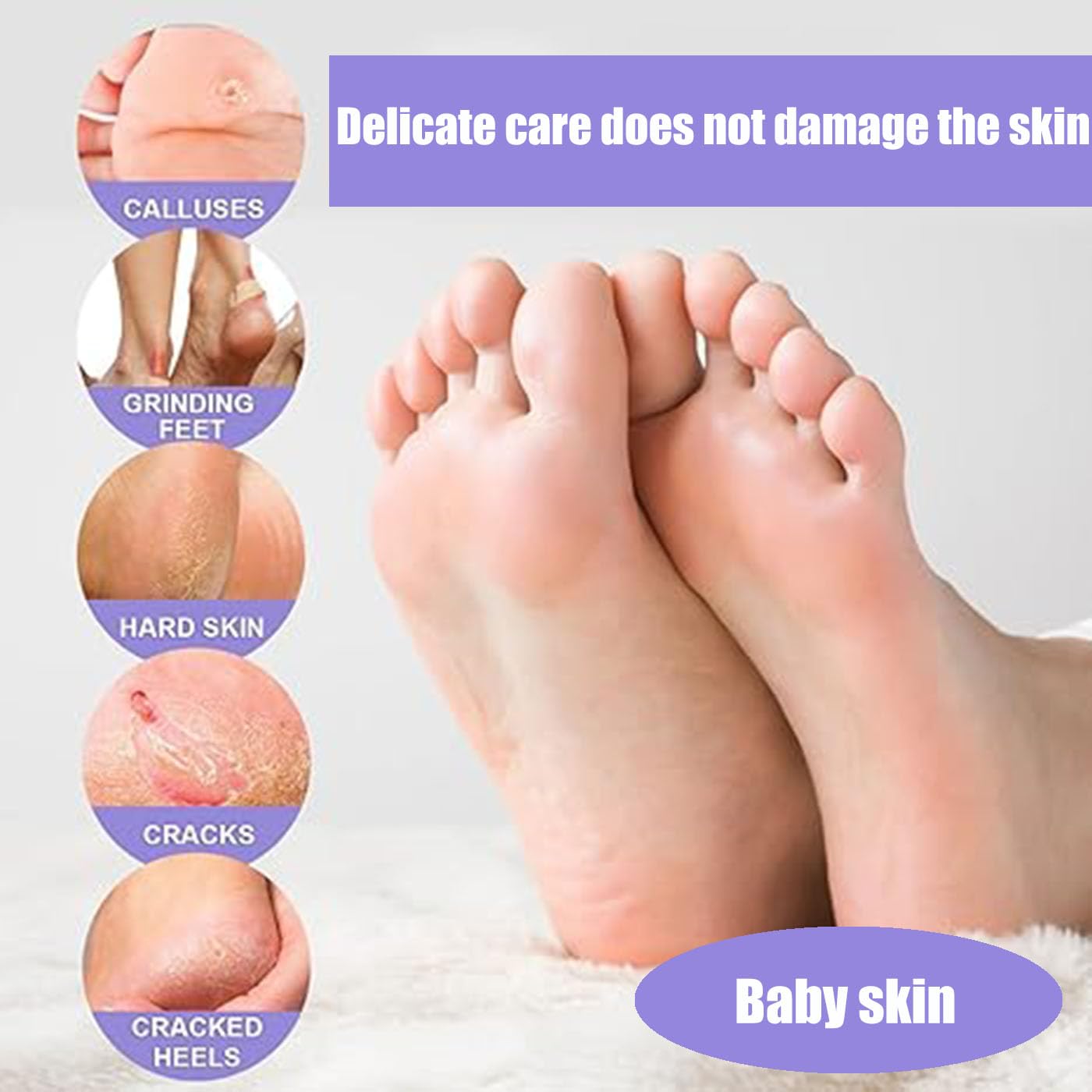 Mckkymi foot peel mask 5 pack shown in at‑home spa setup