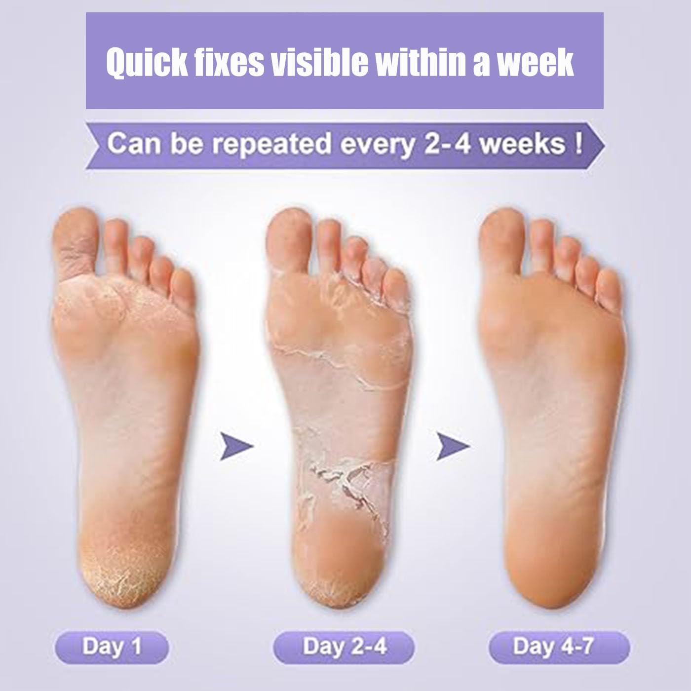 Mckkymi lavender packaging for foot peel mask 5 pack