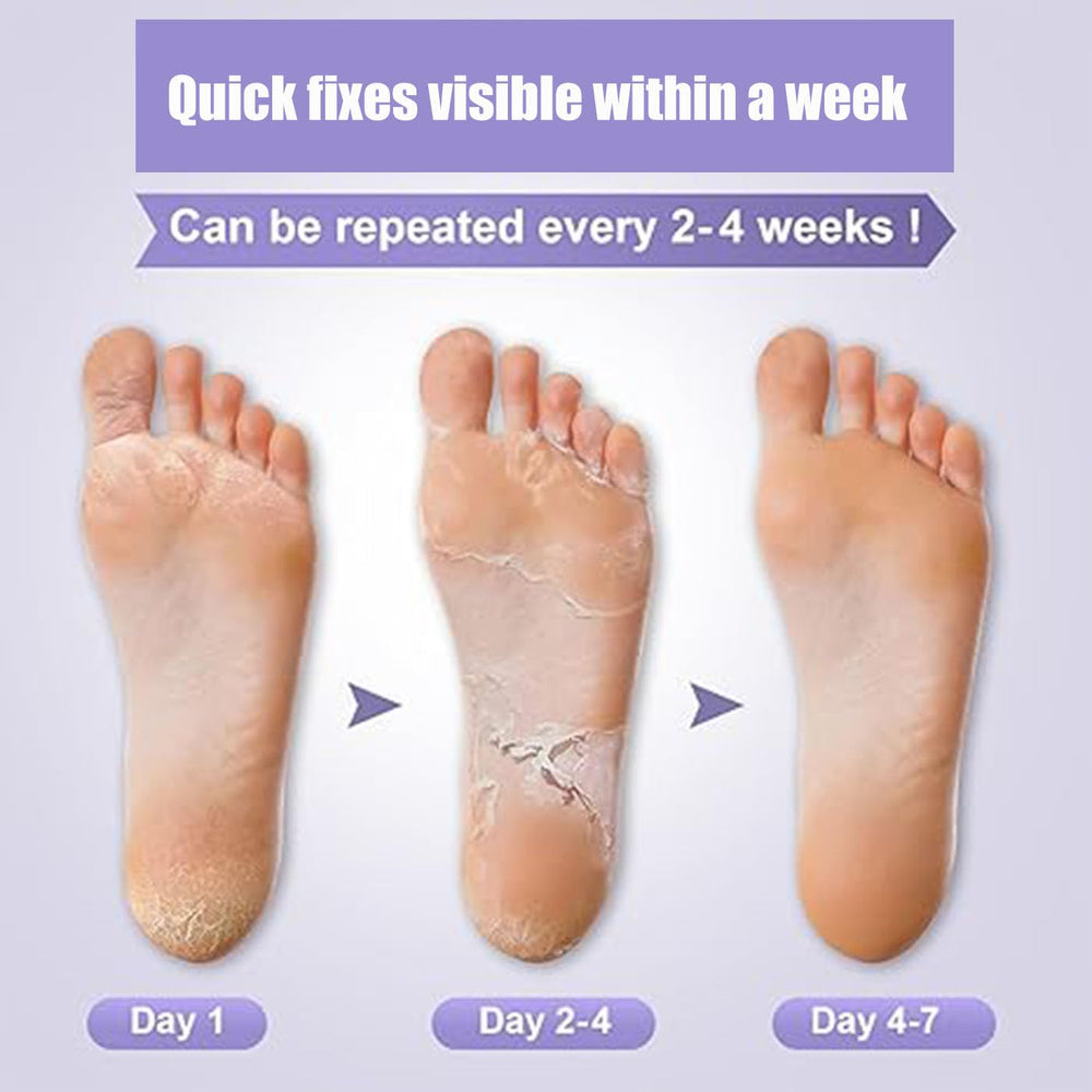 Mckkymi lavender packaging for foot peel mask 5 pack