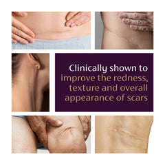 Mederma Advanced Scar Gel on skin showing quick absorption and non-sticky finish