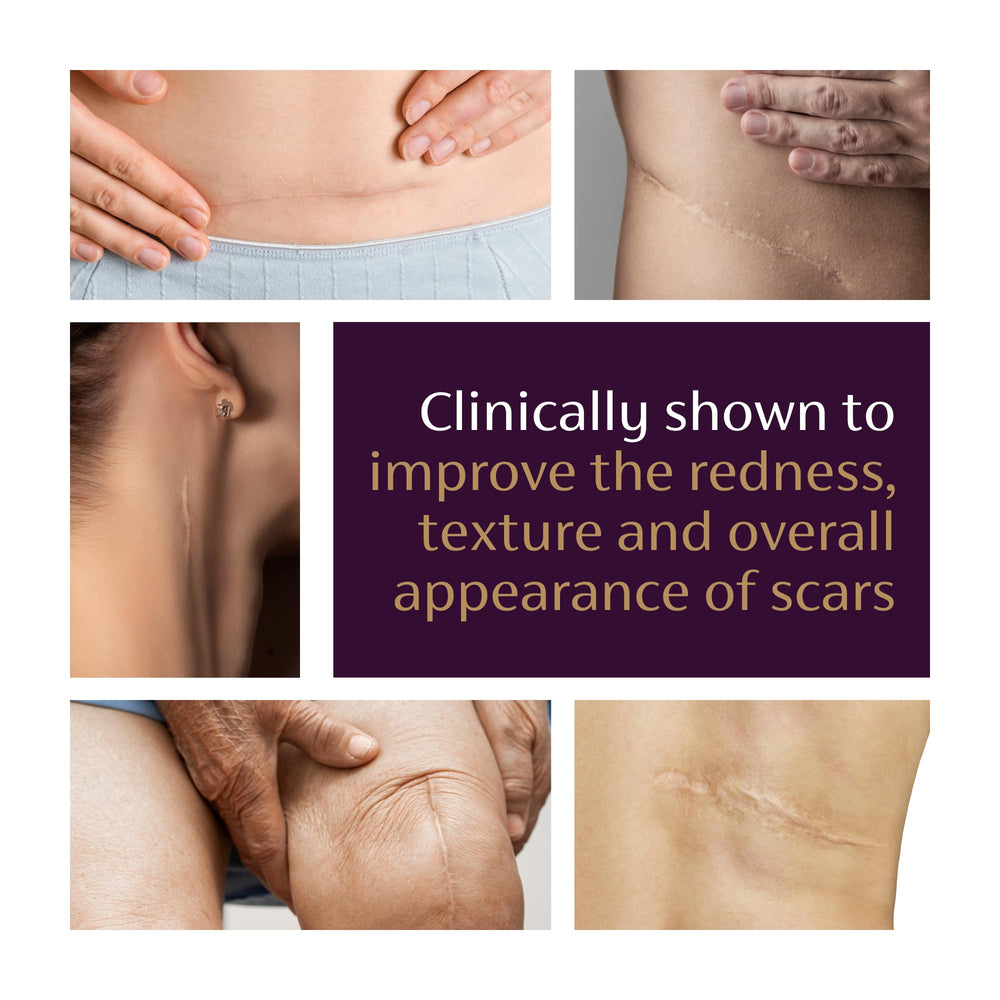 Mederma Advanced Scar Gel on skin showing quick absorption and non-sticky finish