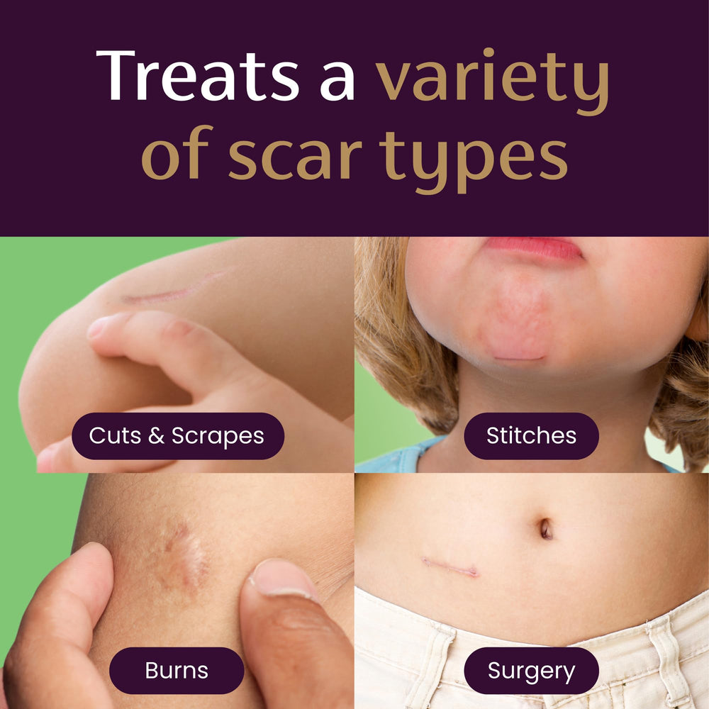 Mederma Scar Gel for Kids absorbs quickly without staining.
