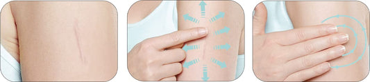 Mederma Skin Care packaging box showing trusted scar management