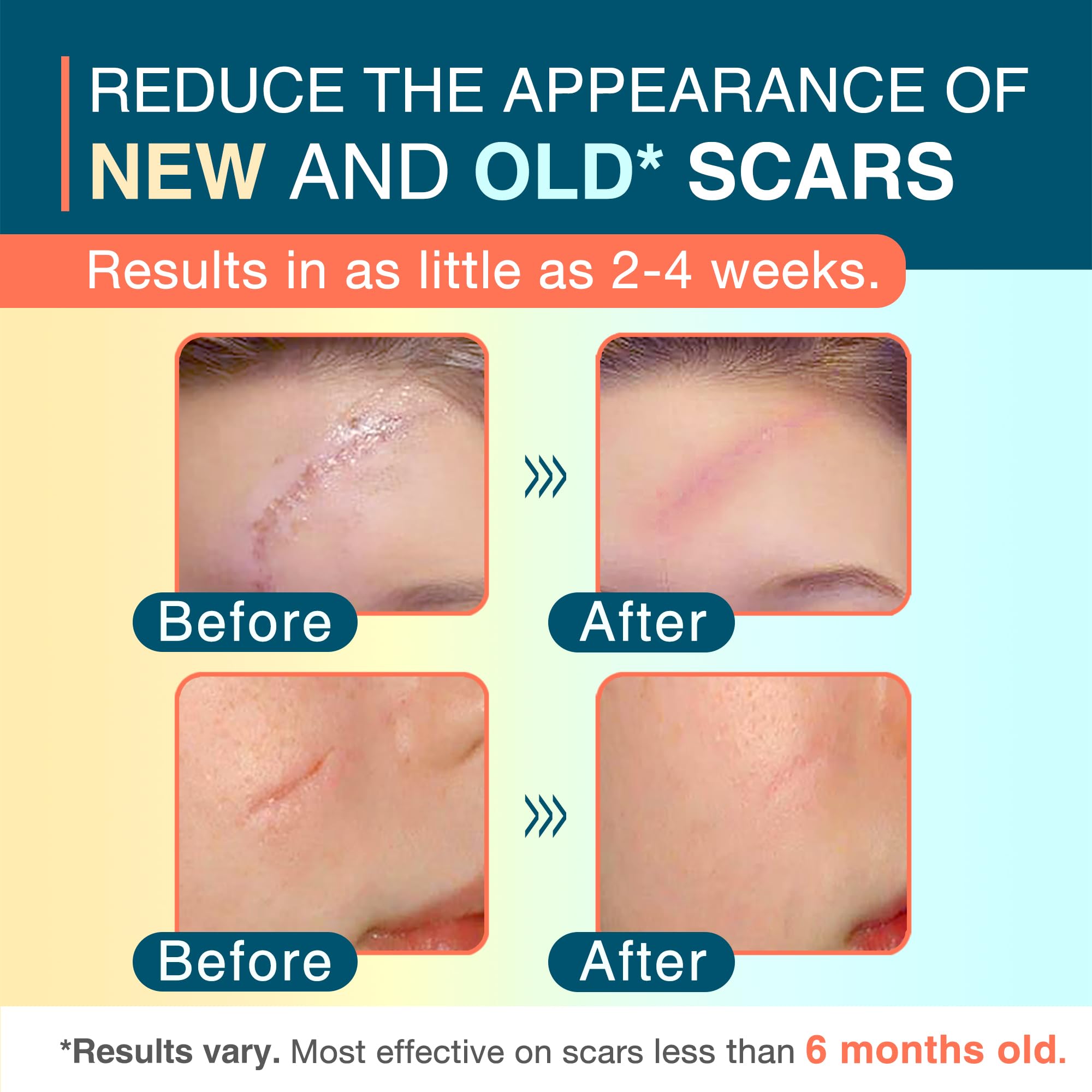 MEDLOT silicone scar sheets being applied to skin for scar care