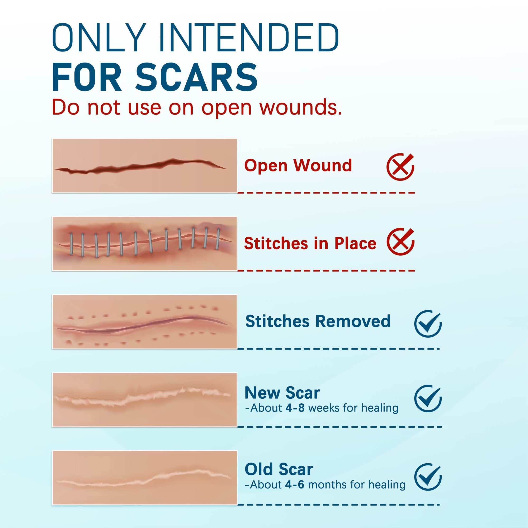 MEDLOT silicone scar sheets provide painless removal with no residue.