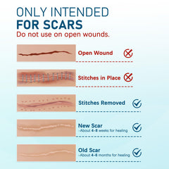 MEDLOT silicone scar sheets provide painless removal with no residue.