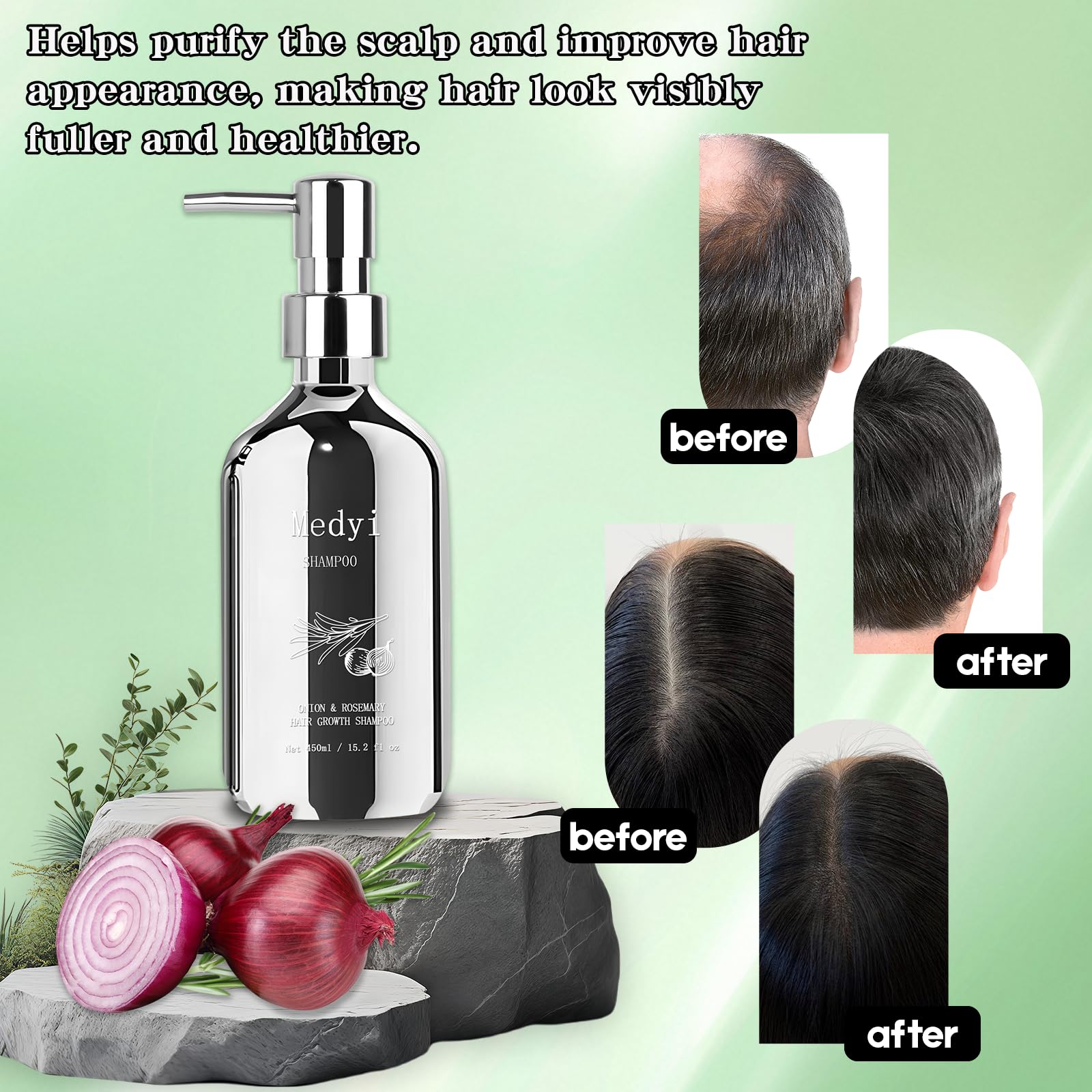 Medyi Onion Rosemary Shampoo pump bottle shown for easy daily dispensing.