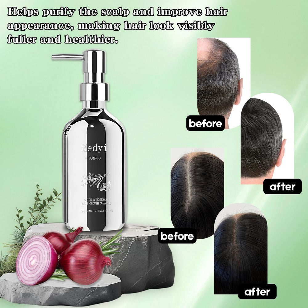 Medyi Onion Rosemary Shampoo pump bottle shown for easy daily dispensing.