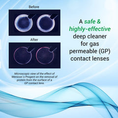 Progent B potassium bromide vials included in the kit