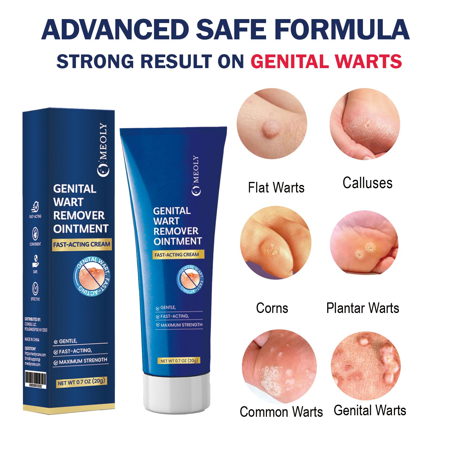MEOLY Genital Wart Remover Cream being applied for precise spot treatment.