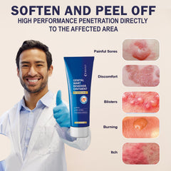 MEOLY Genital Wart Remover Cream packaging highlights compact bottle and clear instructions.