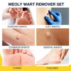 Meoly plantar wart remover pad closeup highlights thick cushioning for comfortable wear