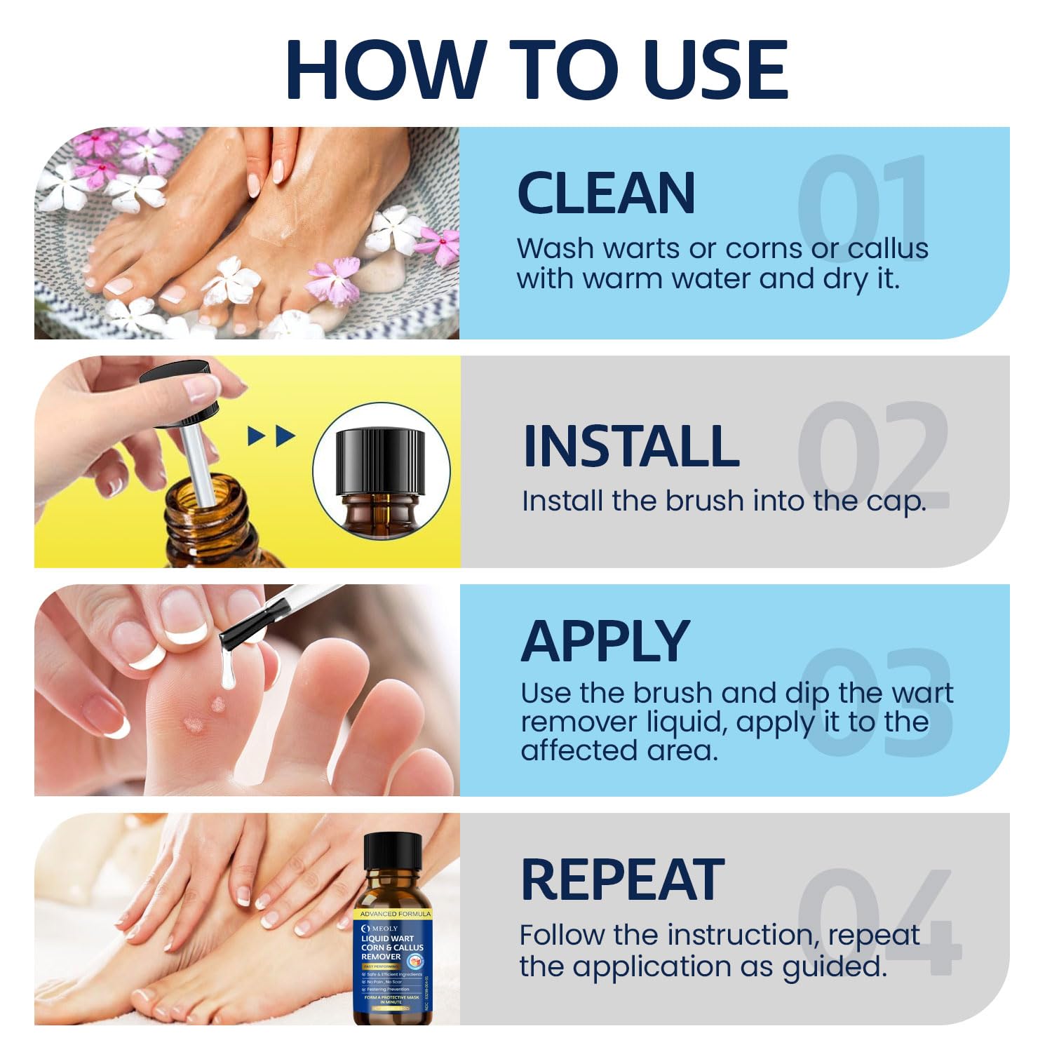 MEOLY plantar wart treatment on the foot area for targeted care