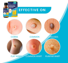 MEOLY plantar wart treatment provides targeted foot care with faster relief.