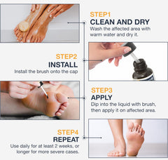 MEOLY Wart Remover helps with corns and calluses for focused care.