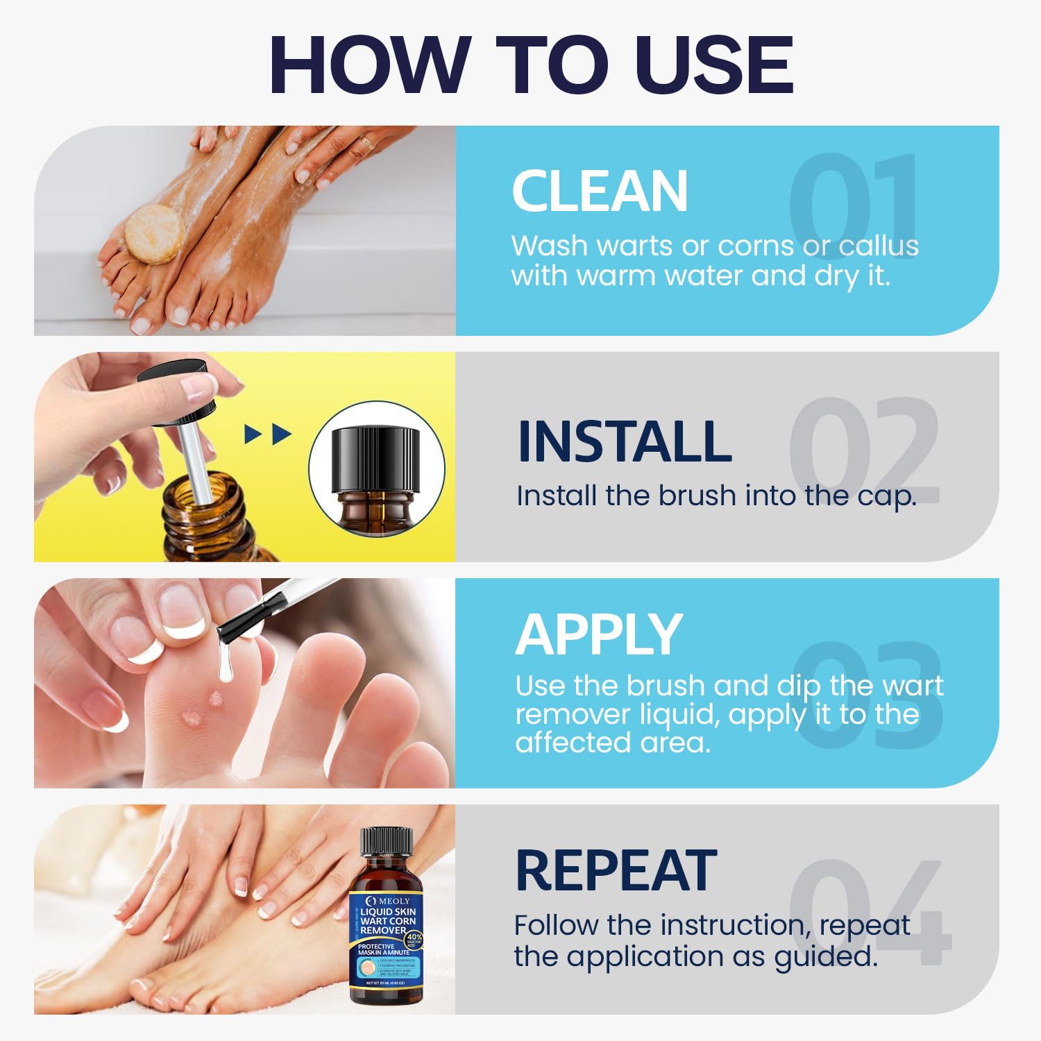 MEOLY wart remover freeze-action cap demonstrates fast treatment.