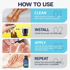 MEOLY wart remover freeze-action cap demonstrates fast treatment.