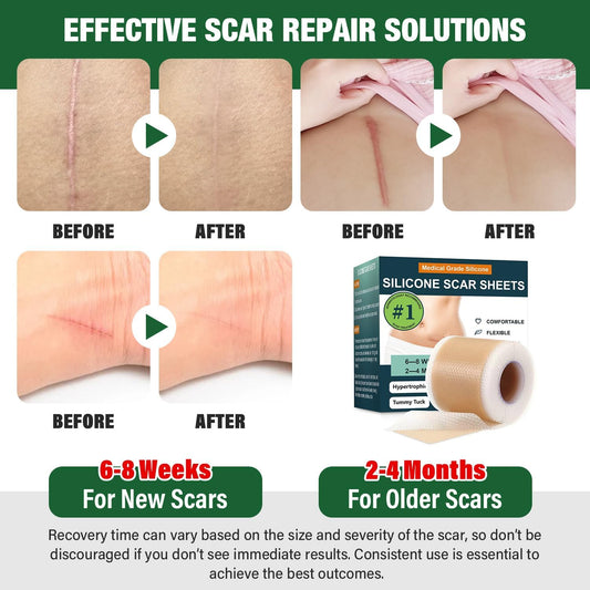 Micakin silicone scar tape pack displayed for easy cut-to-fit application.