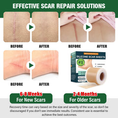 Micakin silicone scar tape pack displayed for easy cut-to-fit application.