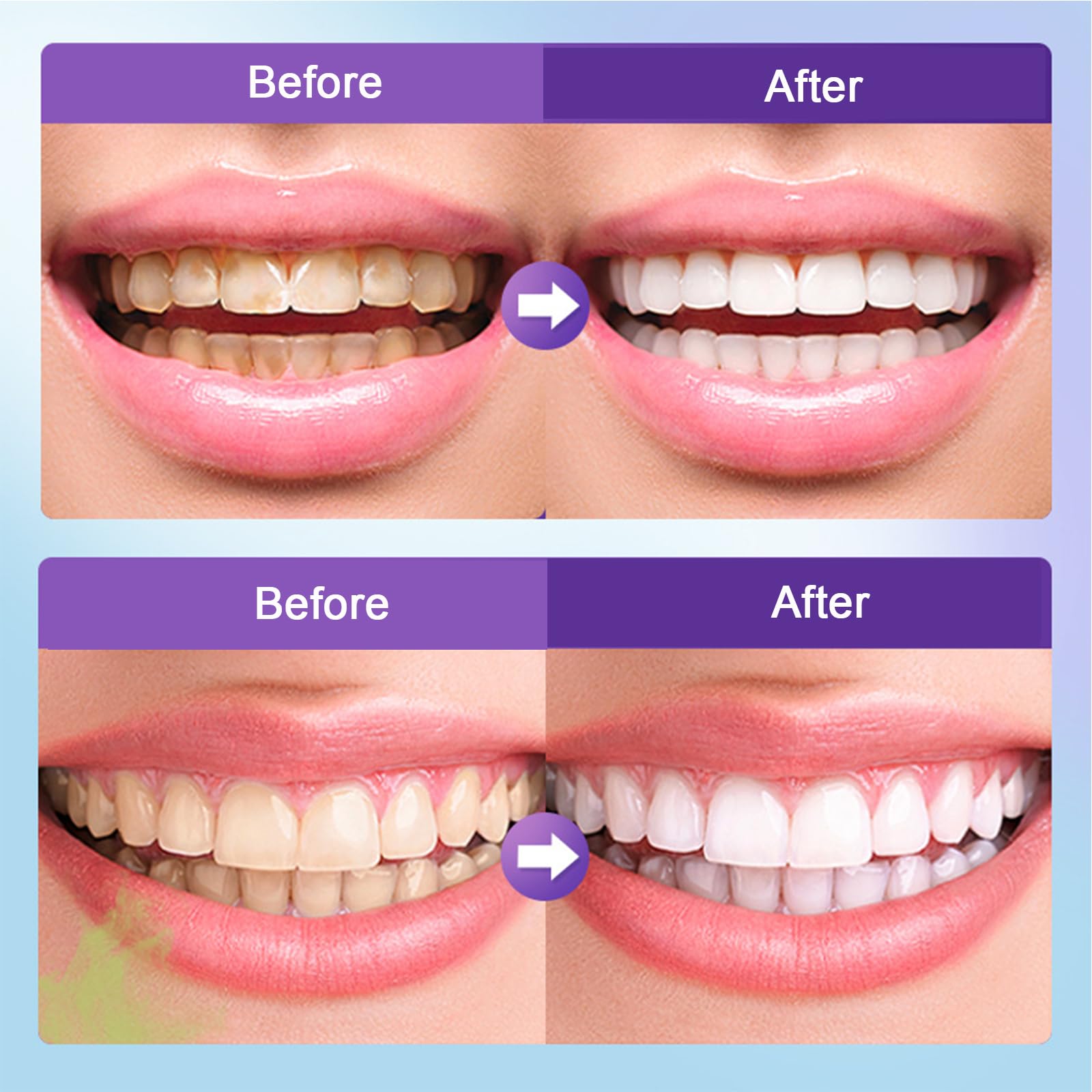 Daily-use microcrystalline hydroxyapatite powder for teeth care