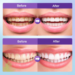 Daily-use microcrystalline hydroxyapatite powder for teeth care