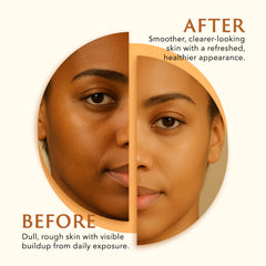 Mine Turmeric Kojic Acid Soap Bar vitamin C emphasis on brightness.