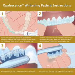 Opalescence 45% mint gel syringe refills for at-home whitening
