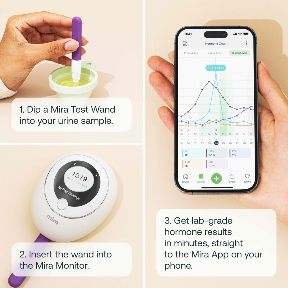 AI-powered insights dashboard on Mira app