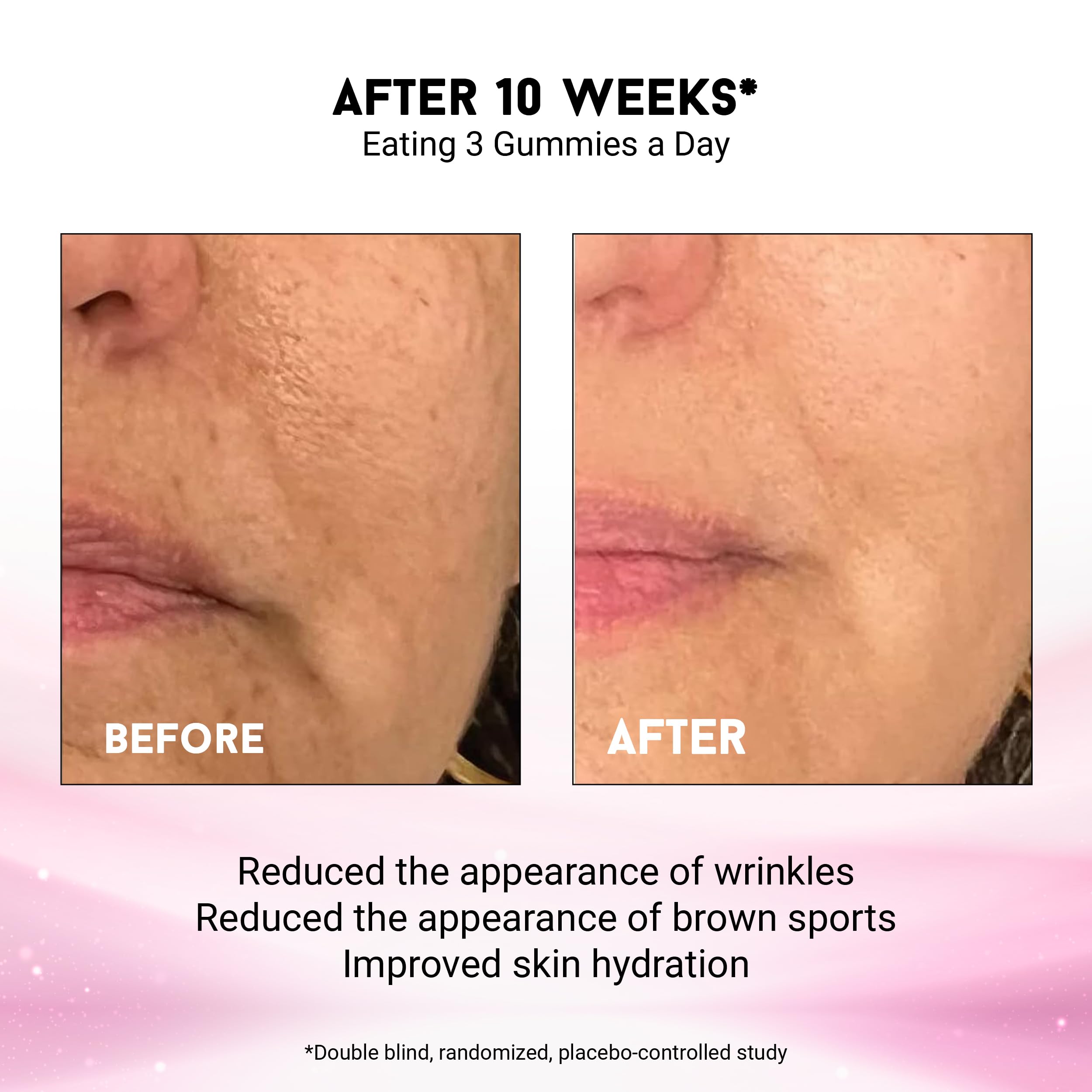 Illustration of skin barrier support and smooth, resilient skin