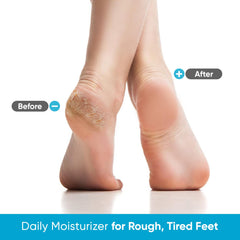 Miratiful soft feet after use with non-greasy hydration.