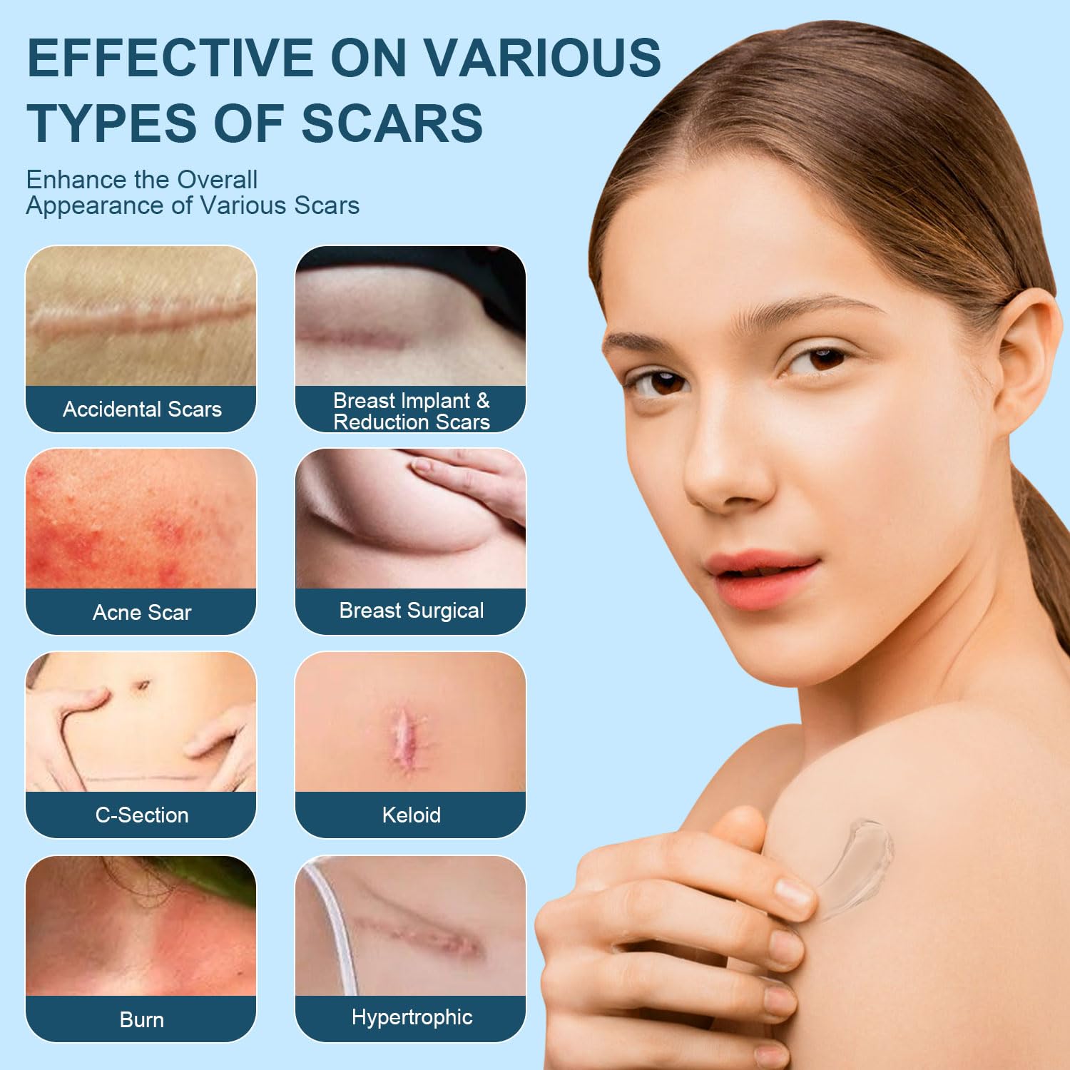 Mitgary Advanced Scar Gel bottle closeup shows smooth, non-greasy texture.