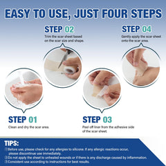Mitreal silicone scar sheet in clinical settings supports consistent management
