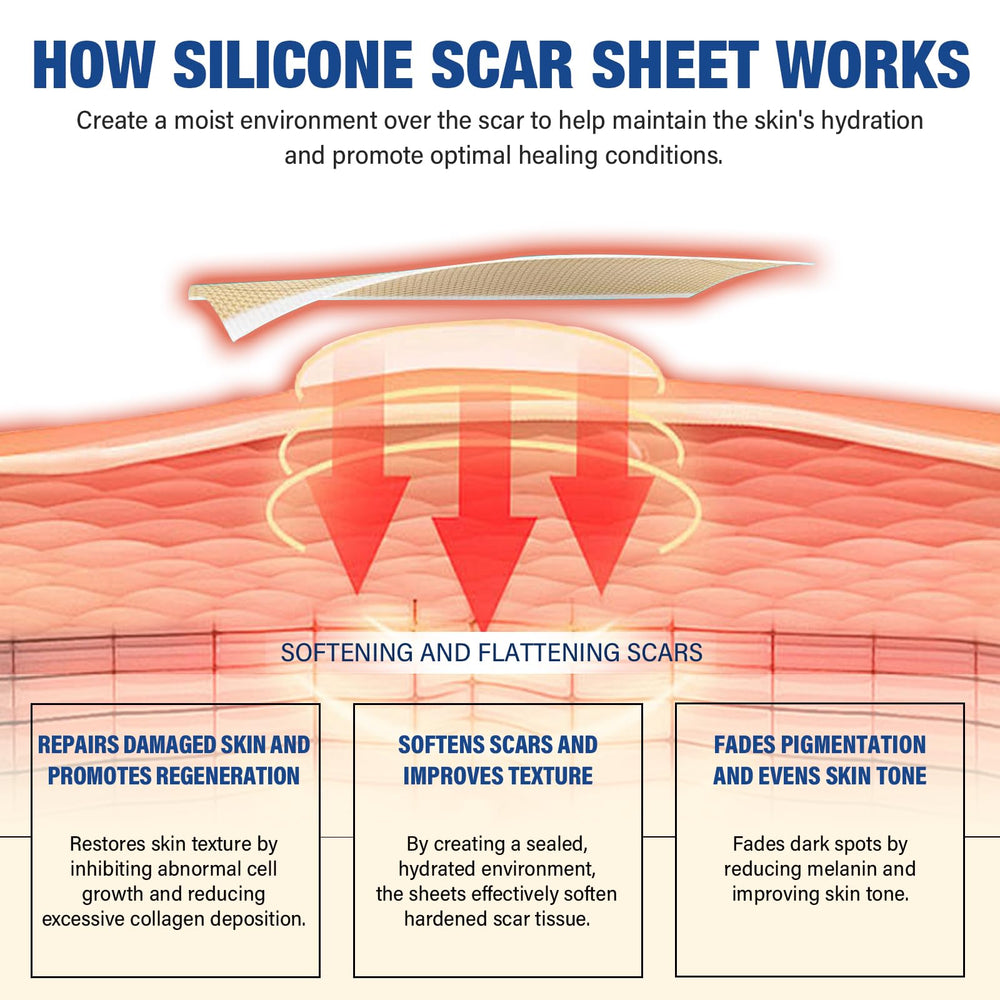 Mitreal scar sheets close-up in medical-grade silicone for sensitive skin